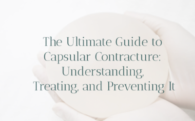 The Ultimate Guide to Capsular Contracture: Understanding, Treating, and Preventing It